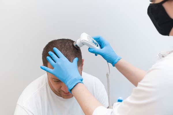 Implante capilar - tricóloga realizando un estudio del cabello y cuero cabelludo de un paciente