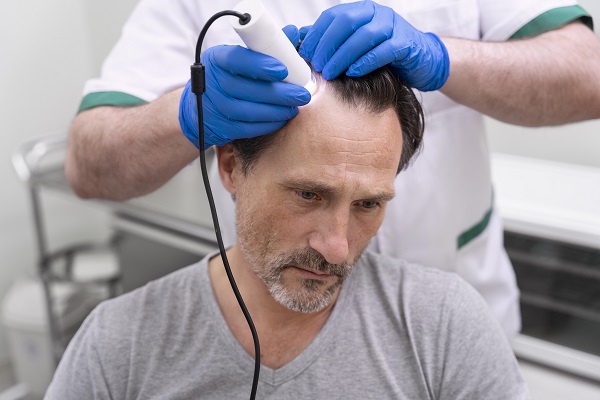 cuánto cuesta un Injerto de cabello - tricólogo en la consulta realizando un estudio del cabello de un paciente