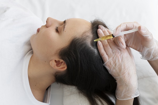 cuánto cuesta un Injerto de cabello - mujer sometiéndose a un PRP como complemento a un tratamiento de implante capilar