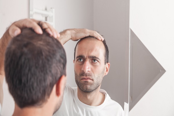 cuánto cuesta un injerto de cabello - hombre delante del espejo pensando en como solucionar sus problemas capilares