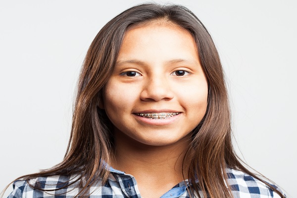 Brackets autoligado, mujer joven de camisa de cuadros azules, sonriendo con sus brackets, como tratamiento de ortodoncia
