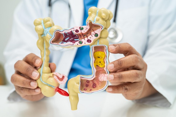 doctor sostiene un modelo de plástico del sistema digestivo