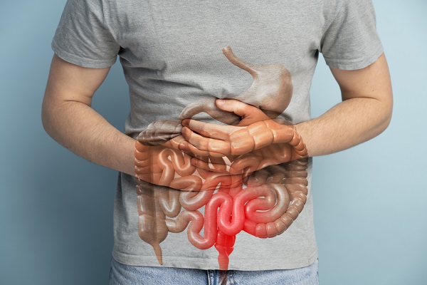 Cáncer de colon en México: síntomas, causas y tratamientos efectivos en 2025