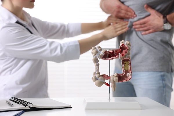 Cáncer de colon - especialista diagnosticando los síntomas y señales tempranas en paciente
