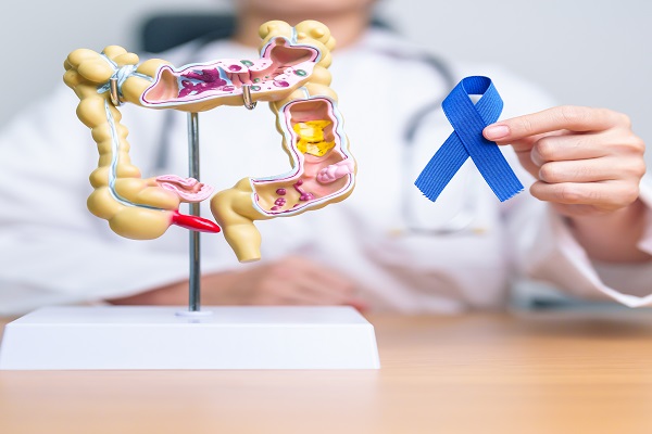 Cáncer de colon - un especialista sosteniendo la cinta azul el símbolo del cáncer de colon 