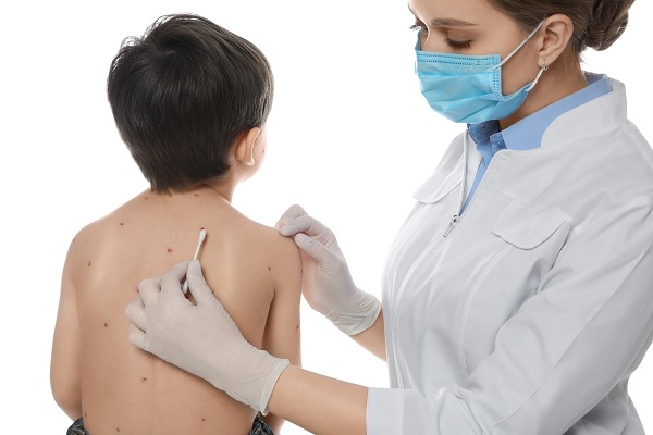 especialista trata la espalda de niño con sarampión 