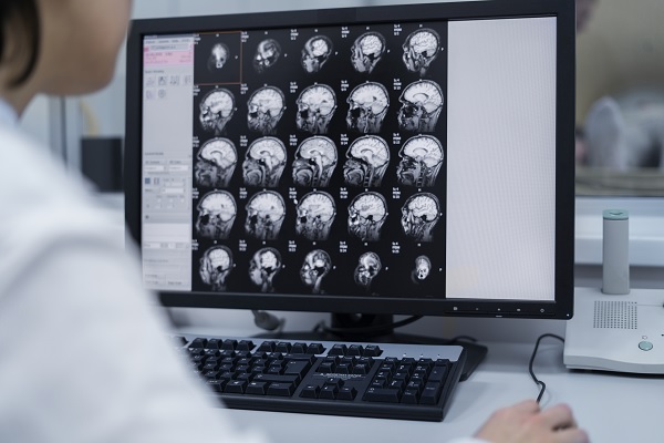 neurología clínica, un neurólogo revisa una tomografía de un paciente, para descartar diagnósticos
