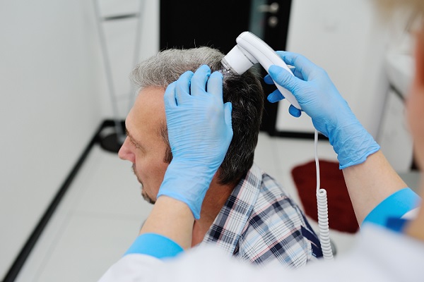 un especialista le aplica un tratamiento laser en el cabello de paciente masculino, lo que es el futuro de la restauración capilar