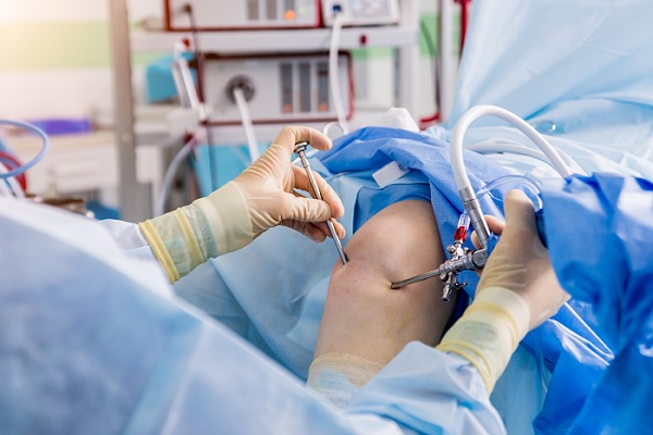artroscopia, un especialista hace un procedimiento medico en una rodilla de un paciente