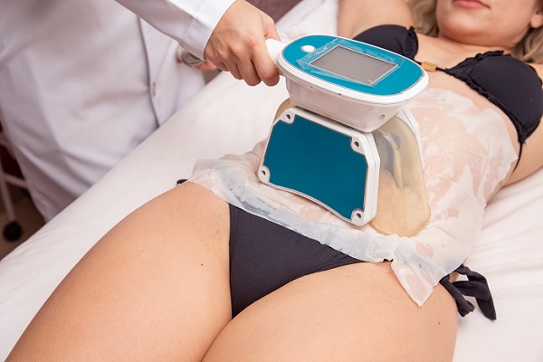 una mujer recibiendo este tratamiento en el abdomen en un centro estético 