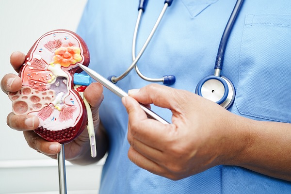 enfermedad renal crónica en México, un especialista explica las etapas de la enfermedad crónica renal