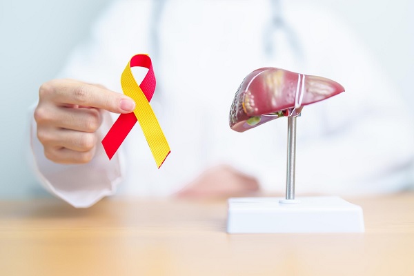 hepatitis A - un doctor sostiene un cinta roja y amarilla, junto a un hígado humano de plastico