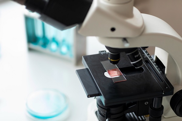cáncer de mama en hombres - se examina una muestra en un microscopio 