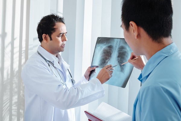 enfermedades más comunes en México - dos especialistas examinan rayos x de pulmones de persona con un enfermedad respiratoria posiblemente tuberculosis 