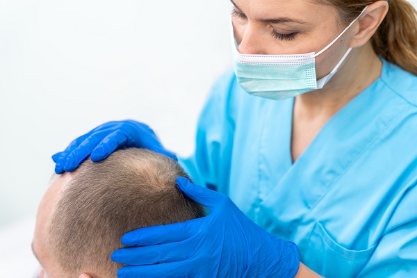 trasplante de cabello precio - una especialista examina el cuero cabelludo de un paciente con alopecia