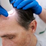 trasplante de cabello precio - hombre recibiendo tratamiento laser en el cabello