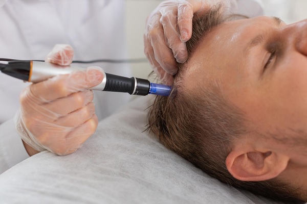 hombre recibiendo un tratamiento capilar mejorar el crecimiento del cabello