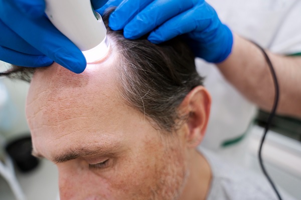 Trasplante de cabello precio en México: crecimiento y evolución en  CDMX durante 2025